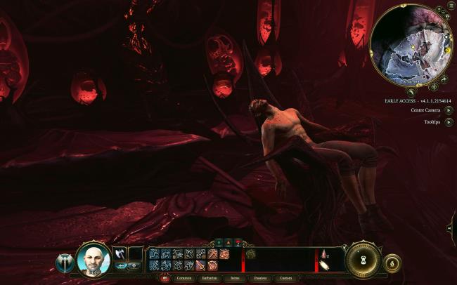 Baldur's Gate 3: An image of the talking brain location in game.