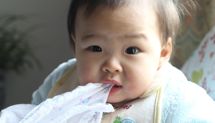 猴痘在儿童，青少年是罕见和很少严重：疾病控制中心